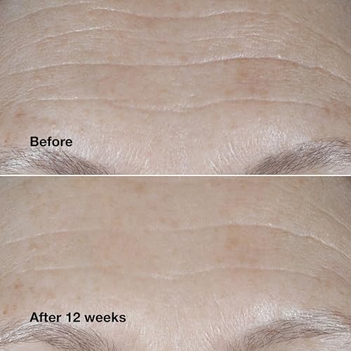 Clinique Smart Clinical Repair SPF 30 Wrinkle Cream with Peptides - Zyphoria