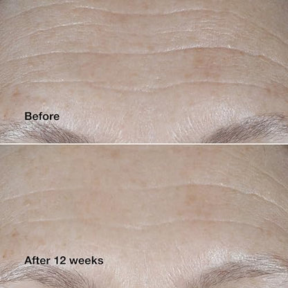 Clinique Smart Clinical Repair SPF 30 Wrinkle Cream with Peptides - Zyphoria